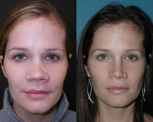 Emily Reed’s Transformation