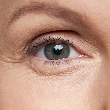 Eye