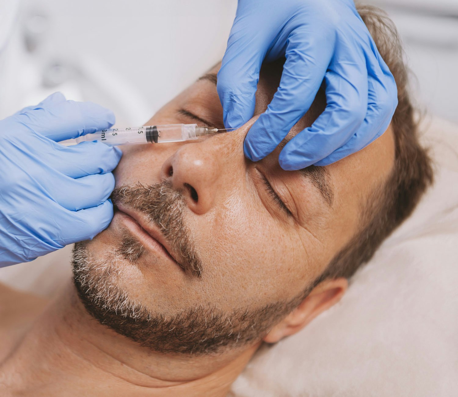 Man getting a liquid rhinoplasty