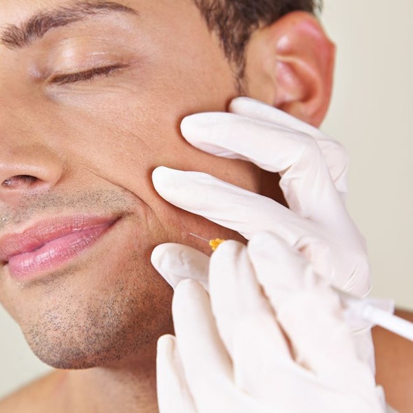 Injection into lines around mouth